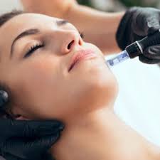 Microneedling with Polynucleotides-(Salmon DNA)